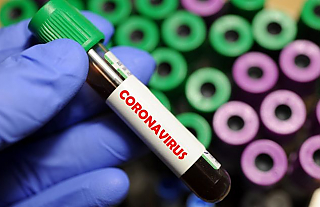 Как сделать тест на коронавирус